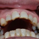 Địa chỉ điều trị tủy răng nào uy tín, hiệu quả tốt nhất? Địa chỉ điều trị tủy răng nào uy tín, hiệu quả tốt nhất?