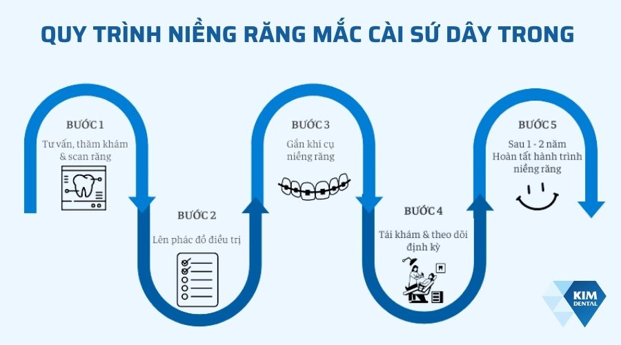 quy trình niềng răng mắc cài dây trong