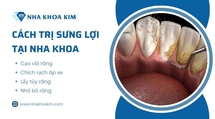 cách chữa lợi bị sưng tại nha khoa
