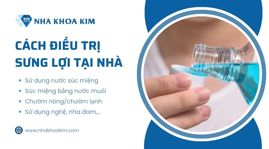 cách điều trị sưng lợi tại nhà