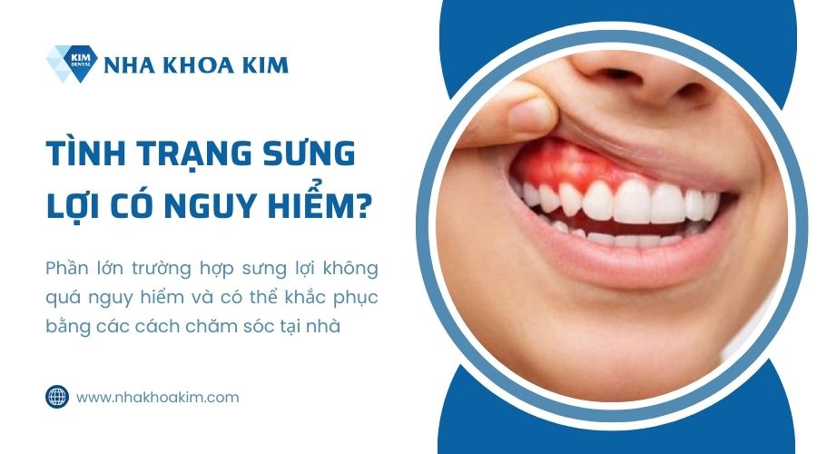 sưng lợi có nguy hiểm không