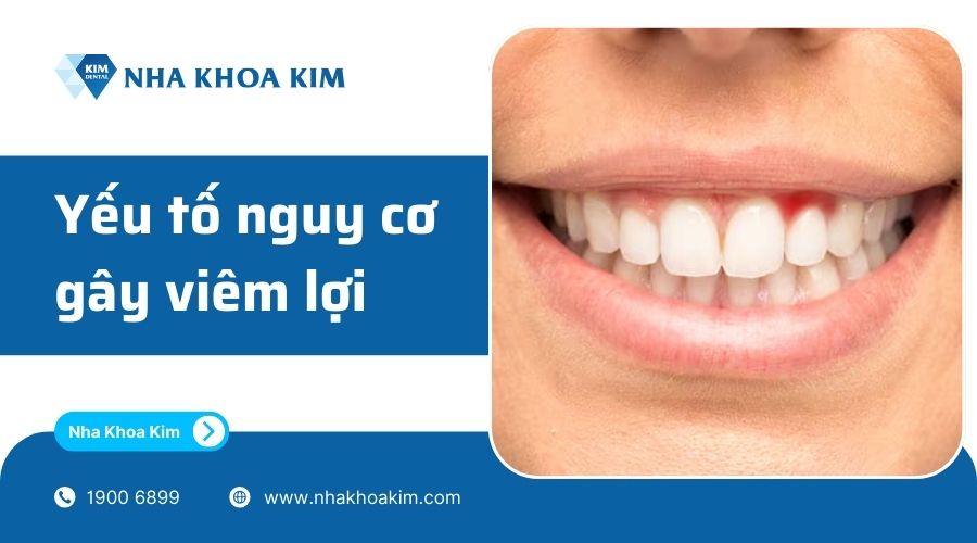 dấu hiệu nhận biết viêm nhiễm ở lợi
