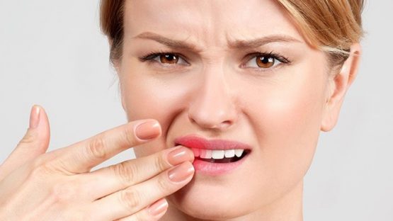 Răng bị lung lay do đâu? Khắc phục bằng cách nào tốt nhất?