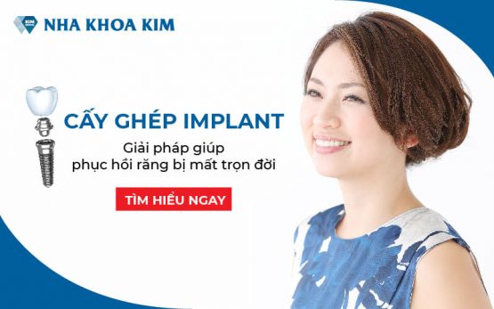 Dịch vụ cấy ghép Implant tức thì chất lượng tốt hiện nay