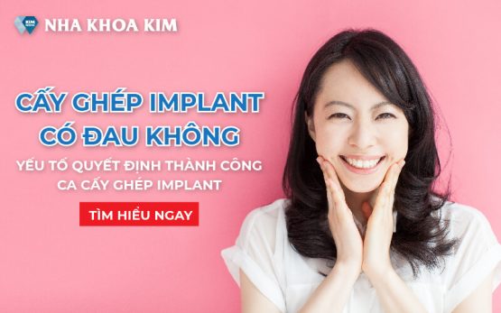 Cấy ghép Implant có đau không? Yếu tố quyết định ca thành công
