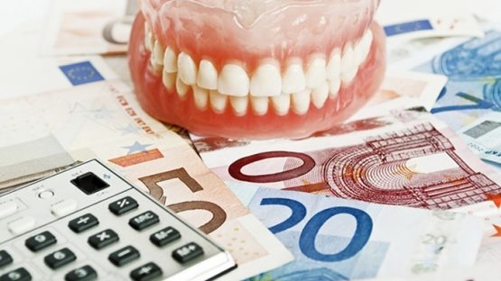 Bọc răng sứ trả góp – Giải pháp thanh toán linh hoạt cho khách hàng