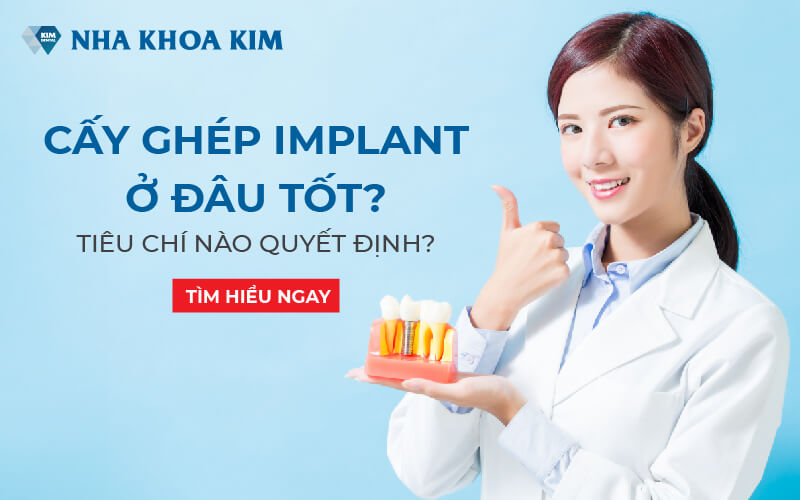 Trồng răng Implant uy tín ở đâu? Tiêu chí nào quyết định?