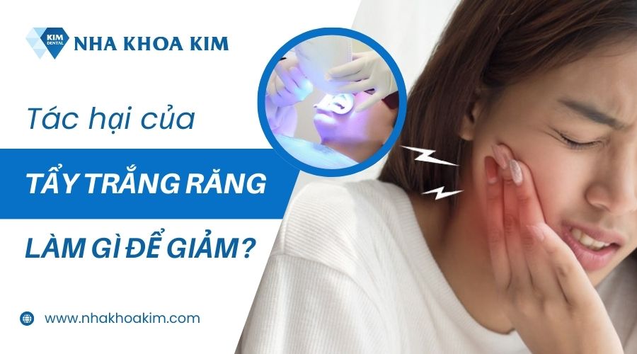 Lưu ý để giảm tác hại tẩy trắng răng