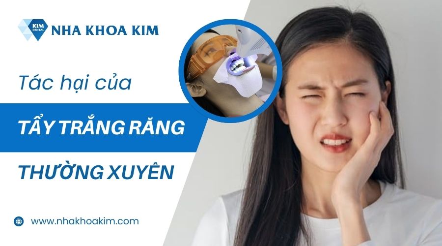 Tác hại của tẩy trắng răng thường xuyên
