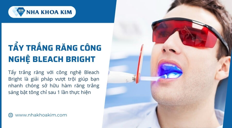 Tẩy trắng răng bằng công nghệ Bleach Bright