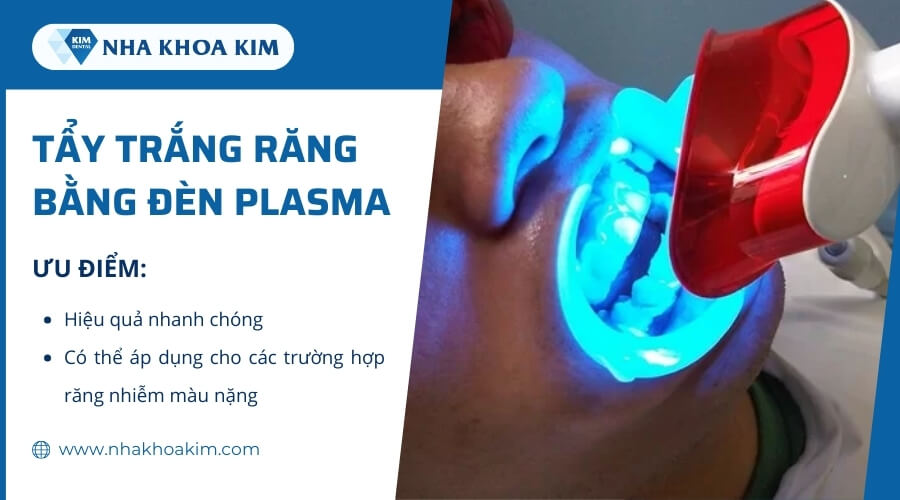 Tẩy trắng răng bằng đèn Plasma 