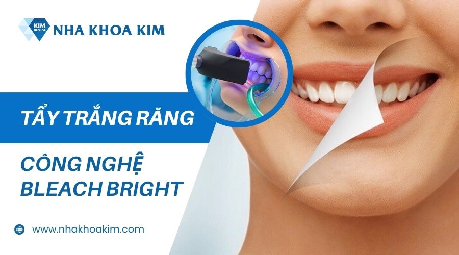 Tẩy trắng răng công nghệ Bleach Bright an toàn, hiệu quả tại Nha khoa KIM