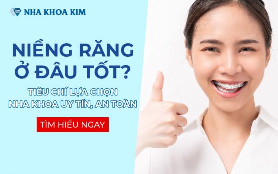 Niềng răng ở đâu tốt? Tiêu chí lựa chọn nha khoa uy tín, an toàn?