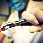 Nhổ răng khôn ở đâu uy tín, an toàn nhiều người đã đến điều trị Nhổ răng khôn ở đâu uy tín, an toàn nhiều người đã đến điều trị