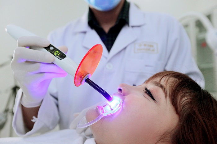 Trám răng Laser Tech – Công nghệ trám răng hiệu quả và thẩm mỹ cao 5