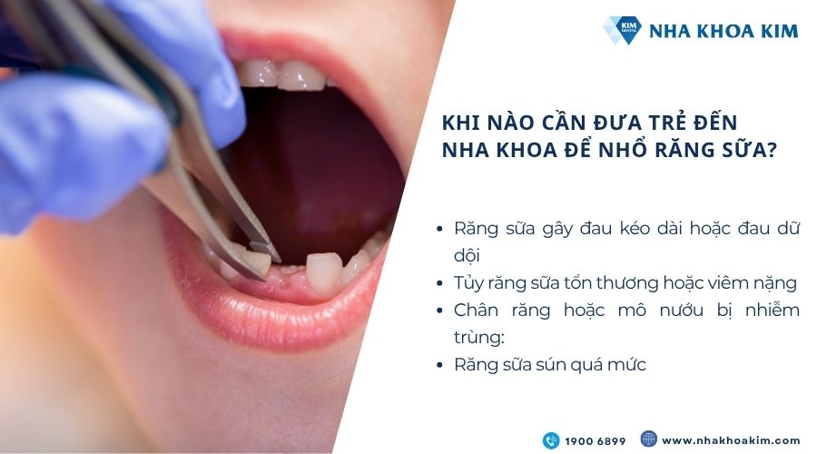 Khi nào cần đưa trẻ đến nha khoa để nhổ răng sữa?