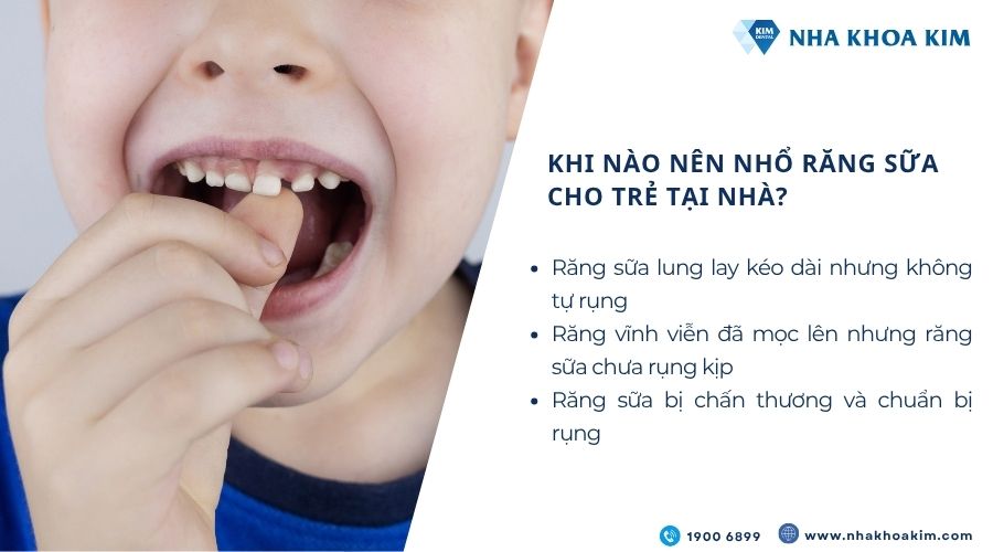 Khi nào nên nhổ răng sữa cho bé tại nhà?