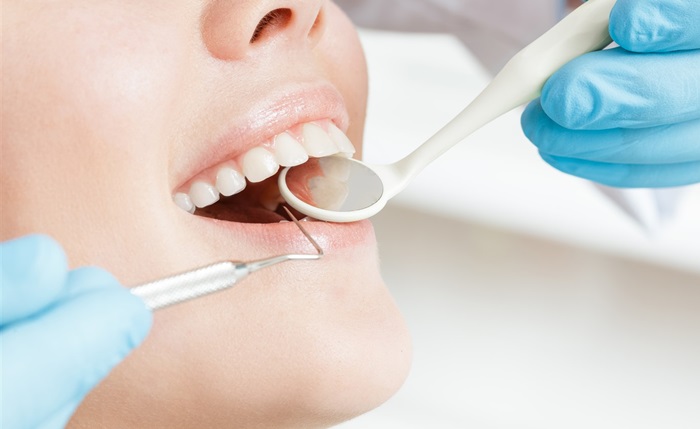 Trám răng cửa – Những lưu ý quan trọng khi phục hình cho răng 3