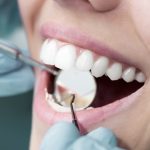 Cách chữa răng hô hiệu quả nhất đang được nhiều người lựa chọn Cách chữa răng hô hiệu quả nhất đang được nhiều người lựa chọn