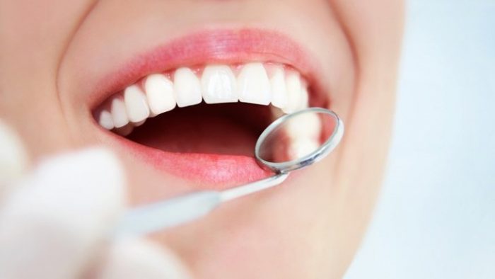 Tẩy trắng răng WhiteMax hiệu quả chỉ sau 1 lần, trắng đẹp lâu dài 01