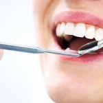 Tẩy trắng răng giá bao nhiêu tiền - Bảng giá cập nhật mới & chuẩn nhất Tẩy trắng răng giá bao nhiêu tiền - Bảng giá cập nhật mới & chuẩn nhất
