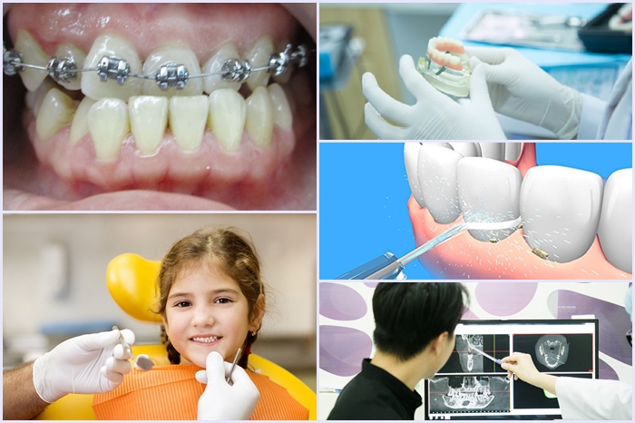 Nha khoa uy tín ở TPHCM - Chăm sóc răng miệng toàn diện 4