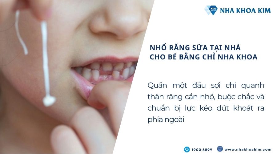 Cách nhổ răng sữa bằng chỉ nha khoa