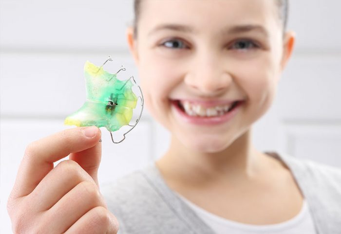 Niềng răng cho trẻ giá bao nhiêu? Phương pháp nào hiệu quả, tiết kiệm? 1