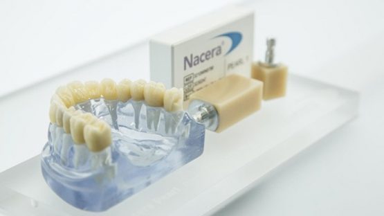 Răng sứ Nacera có tốt không? Giá răng sứ Nacera bao nhiêu tiền?