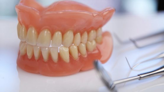 Trồng răng nguyên hàm – Giải pháp phục hồi cho răng bền chắc, thẩm mỹ