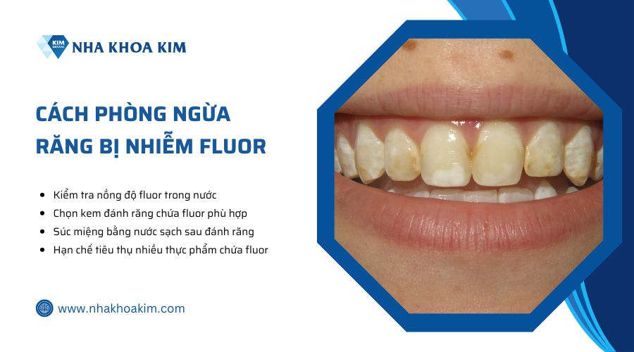Cách phòng ngừa răng nhiễm fluor