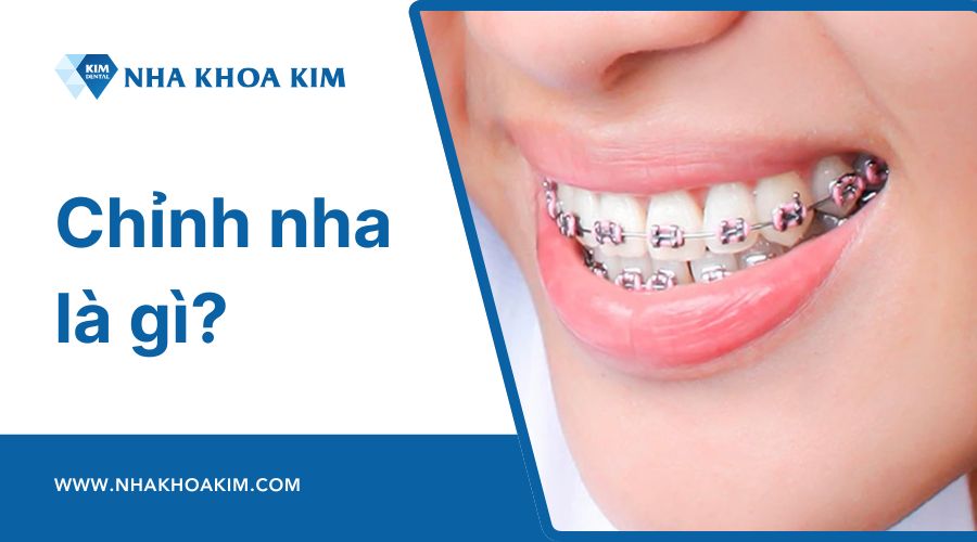 chỉnh nha là gì