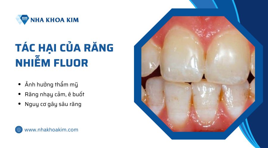 tác hại của răng nhiễm flour