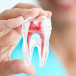 Trám răng lấy tủy – Những mặt lợi và hại mà bạn nên biết Trám răng lấy tủy – Những mặt lợi và hại mà bạn nên biết