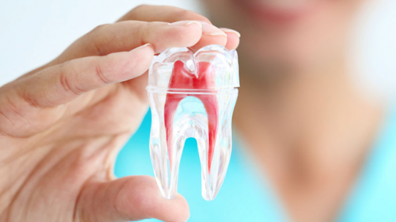 Trám răng lấy tủy – Những mặt lợi và hại mà bạn nên biết
