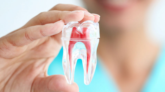 Trám răng lấy tủy – Những mặt lợi và hại mà bạn nên biết