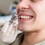 Đánh bóng răng là gì và những thông tin cơ bản bạn nên biết Đánh bóng răng là gì và những thông tin cơ bản bạn nên biết