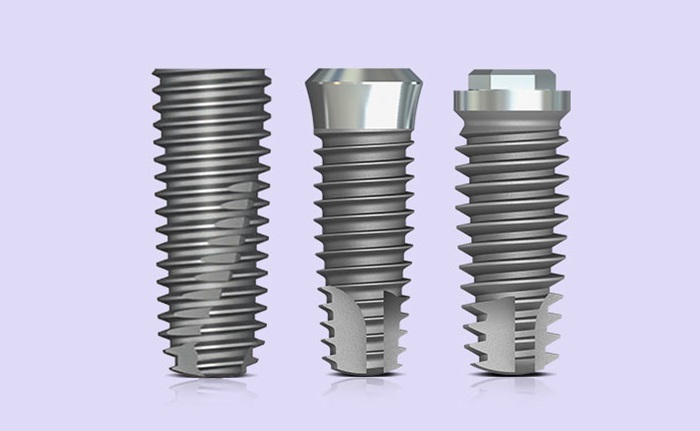 Implant loại nào tốt nhất được nhiều người chọn lựa? 4