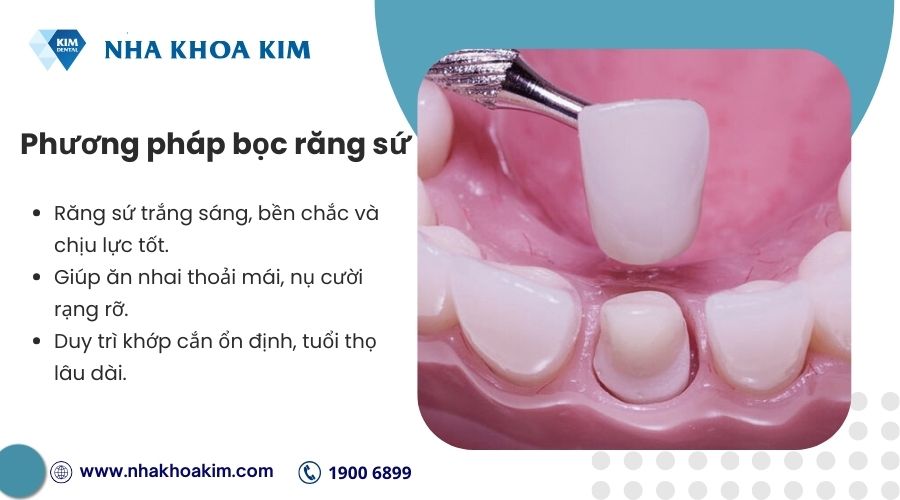 bọc sứ cho răng bị gãy
