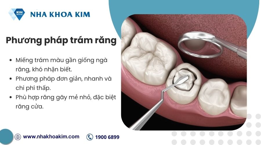 trám răng gãy còn chân răng