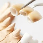 Giải pháp trồng răng sứ giá rẻ mà vẫn đảm bảo thẩm mỹ, bền lâu Giải pháp trồng răng sứ giá rẻ mà vẫn đảm bảo thẩm mỹ, bền lâu