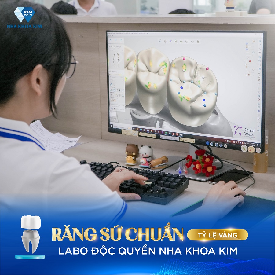 Hệ thống Labo sản xuất răng sứ độc quyền chất lượng tại Nha Khoa Kim quận 12