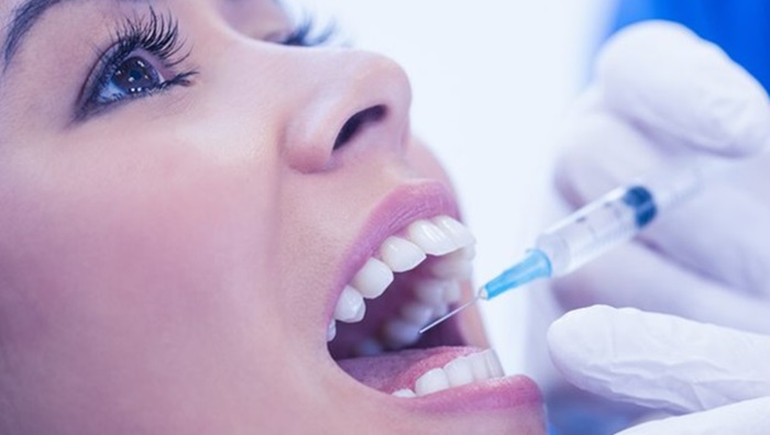 Nhổ răng gây tê hay gây mê? Cách nào an toàn và hiệu quả hơn? 1