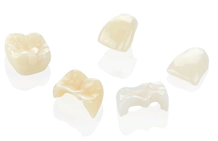 Răng sứ Lava – Giải pháp phục hình răng sứ siêu bền đẹp! 1