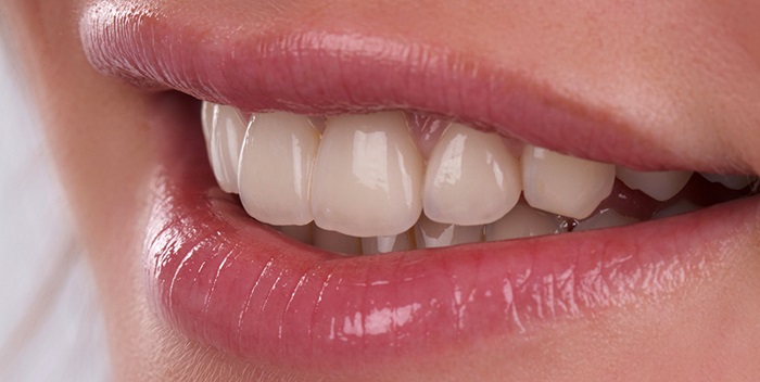 Răng sứ Vita – Sự lựa chọn phục hình răng sứ đẹp hoàn hảo 1