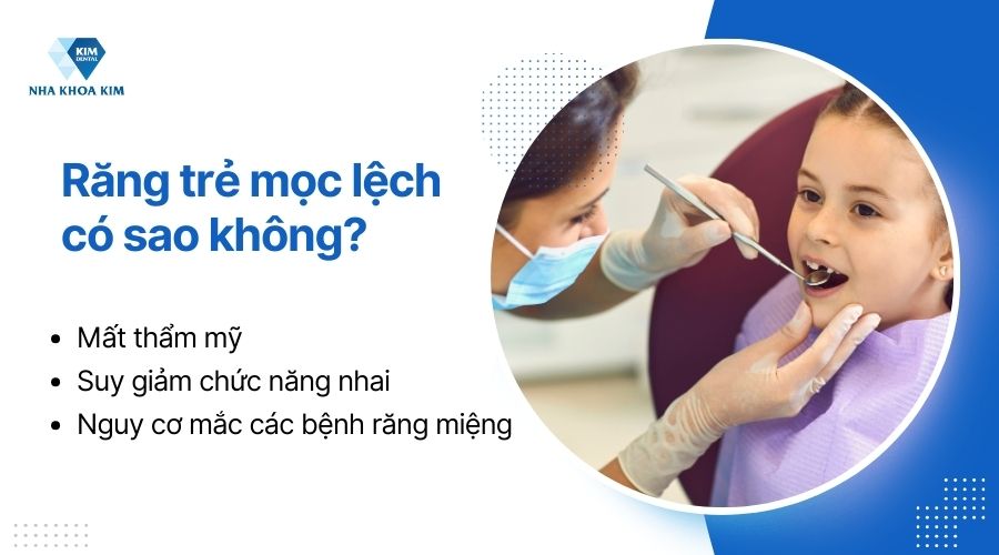 răng mọc lệch sẽ gây mất thẩm mỹ