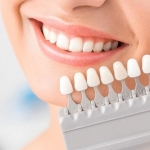 Giới thiệu nha khoa tẩy trắng răng ở đâu tốt và uy tín tại Hà Nội Giới thiệu nha khoa tẩy trắng răng ở đâu tốt và uy tín tại Hà Nội