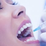 Trồng răng sứ có đau không? Đau nhức bao lâu thì hết? Trồng răng sứ có đau không? Đau nhức bao lâu thì hết?