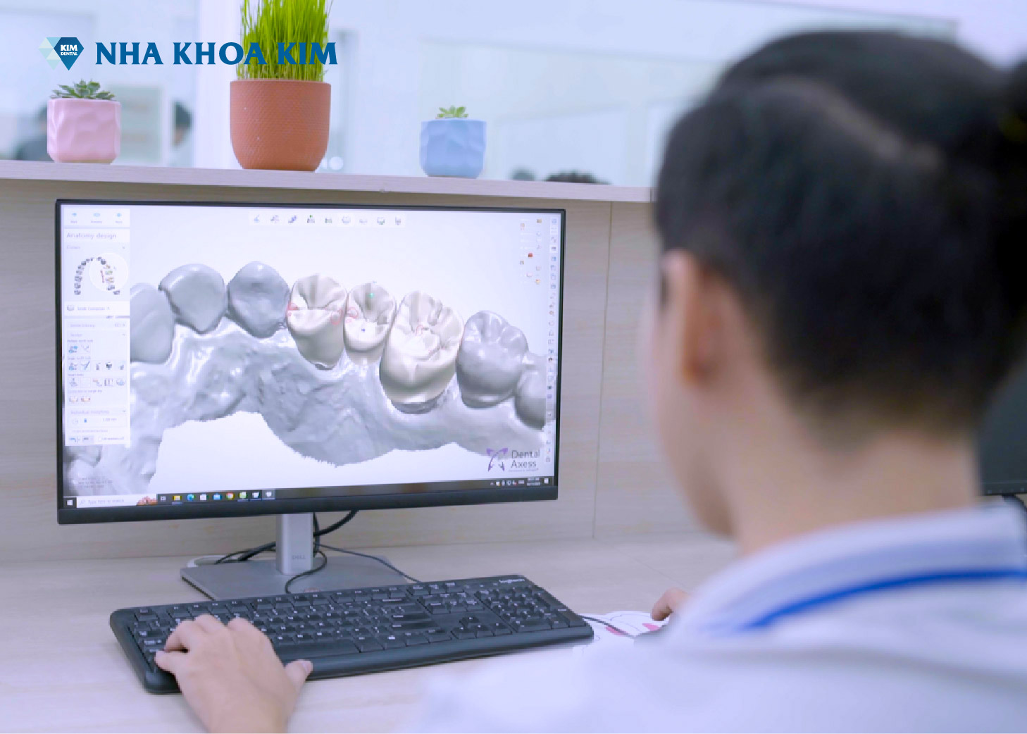 nhà máy răng sứ Nha Khoa Kim