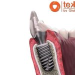 Implant Tekka là gì? Cấy ghép răng implant Tekka có tốt không? Implant Tekka là gì? Cấy ghép răng implant Tekka có tốt không?